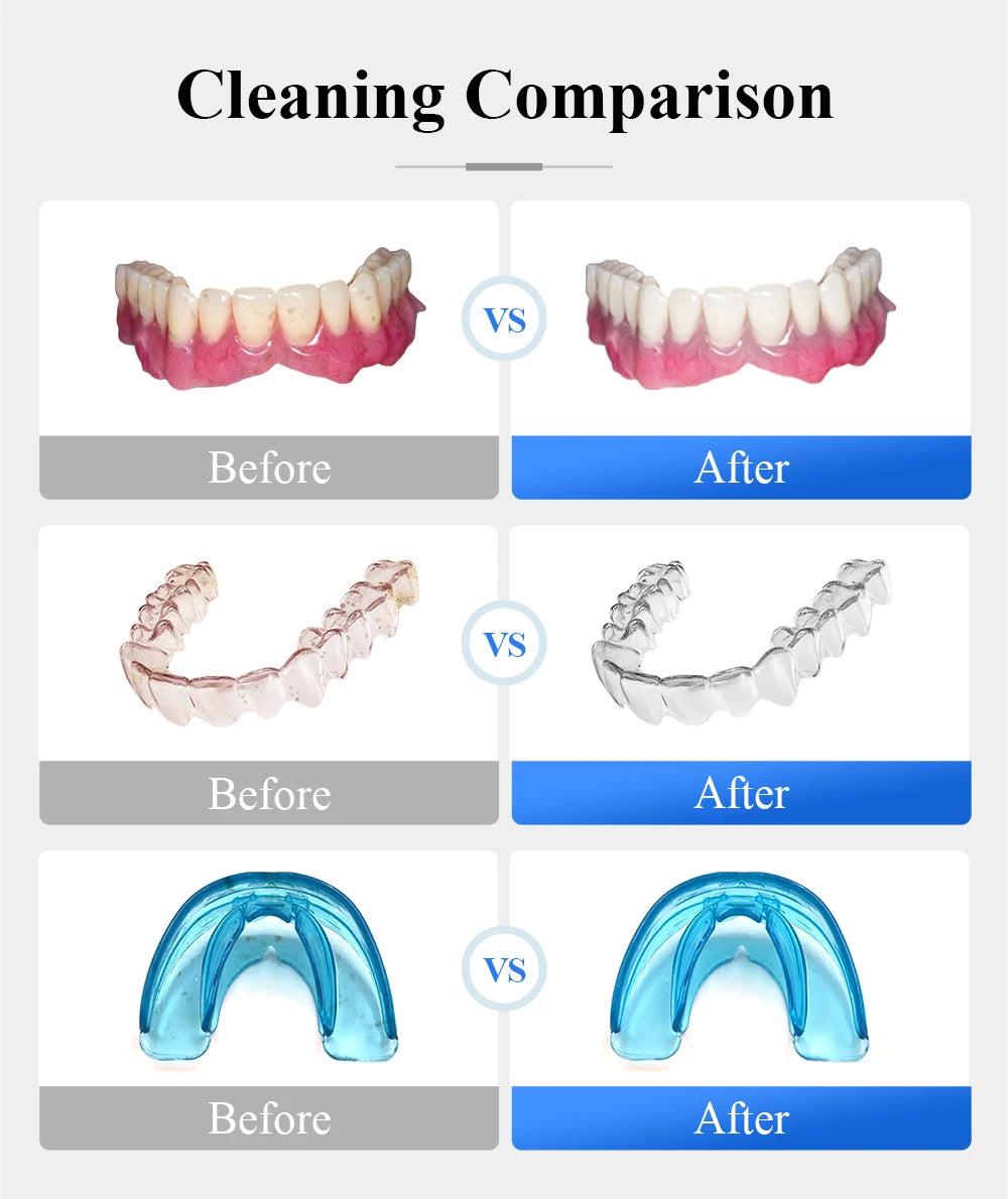 Household Ultrasonic Retainer Cleaner w/UV Light-Denture/Jewelry/Braces Cleaning